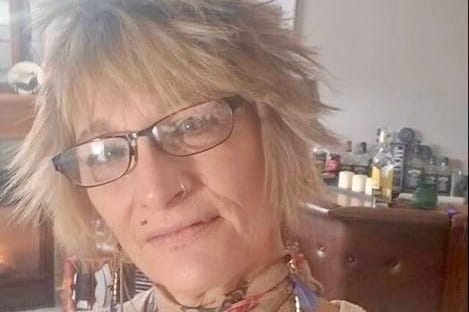 Fundraiser established for Fergus burn victim Cathy Bilton
