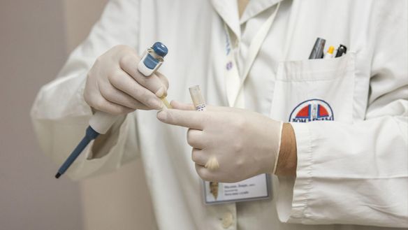 Zika Virus - What It Is And How to Know If You Have It