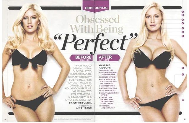 Do You Remember: Heidi Montag’s Ten Cosmetic Surgeries in One Day