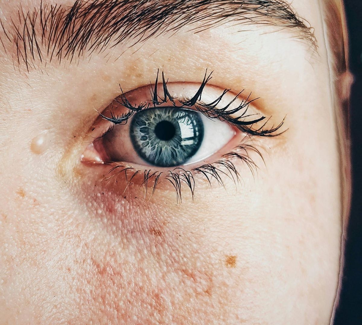 AI and Genetics Reveal New Insights into How the Eye Develops