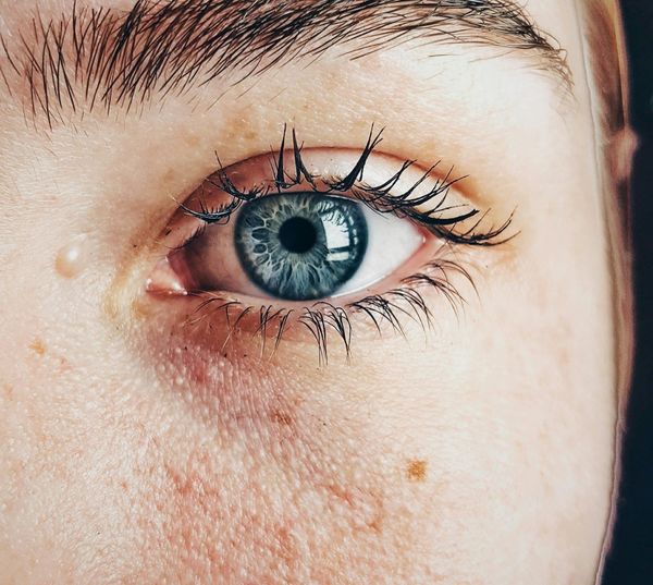 AI and Genetics Reveal New Insights into How the Eye Develops