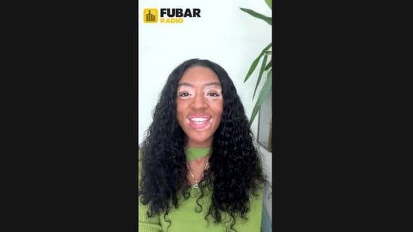Love Is Blind UK’s Yasmin Toseafa Reveals How Embracing Vitiligo Changed Her Life