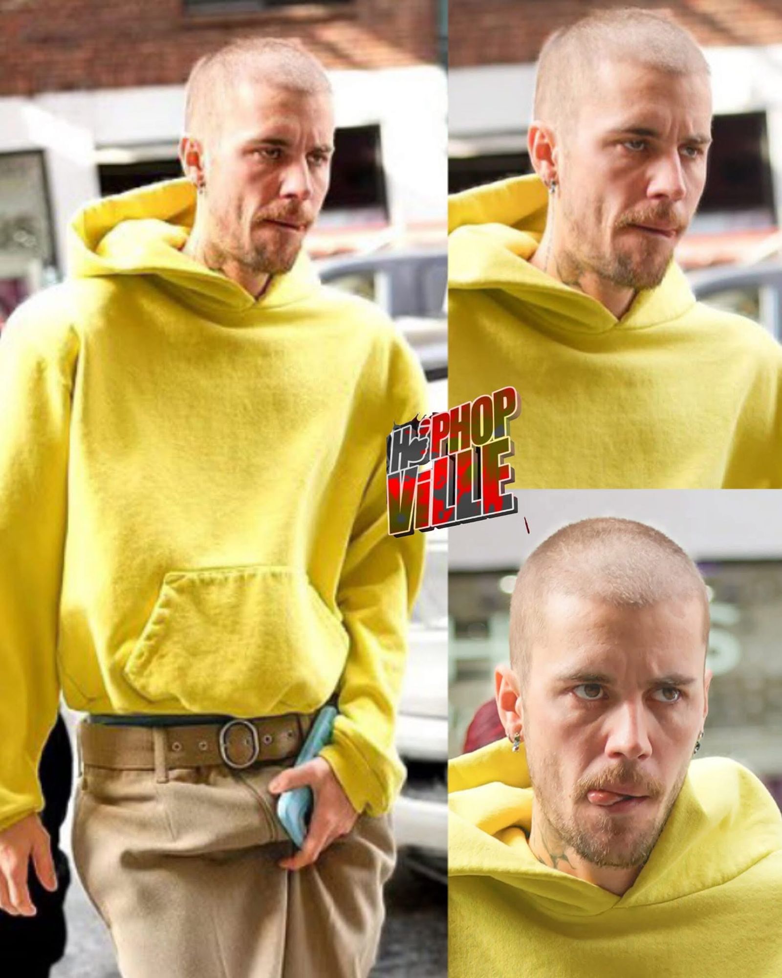 YEET: Justin Bieber’s Shaved Head Sparks Concern Amid Marriage Rumors