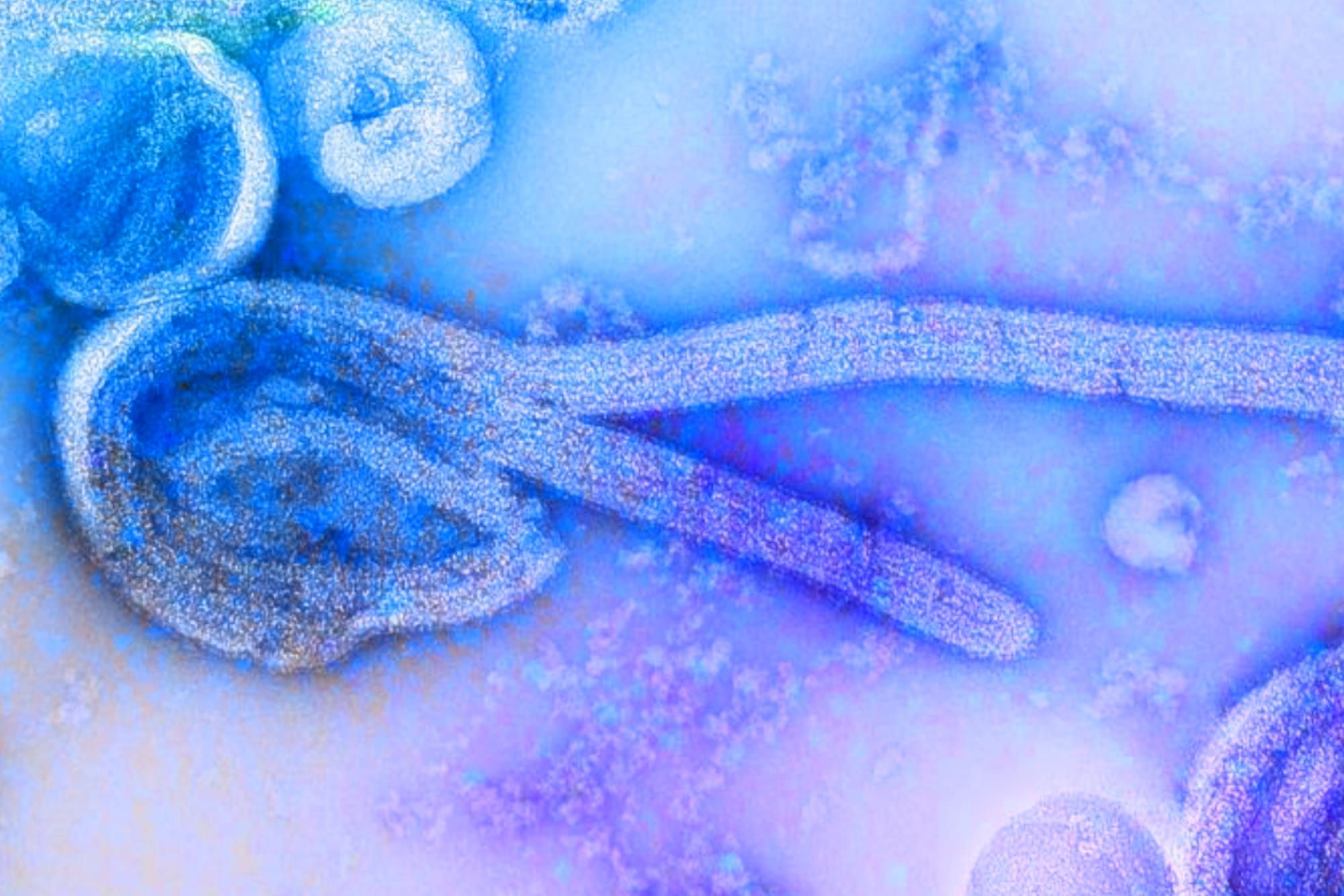 African and European Regulators call for accelerated Ebola vaccine trials