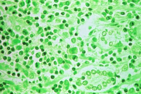 EU activates crisis response mechanism to monitor hantavirus outbreak
