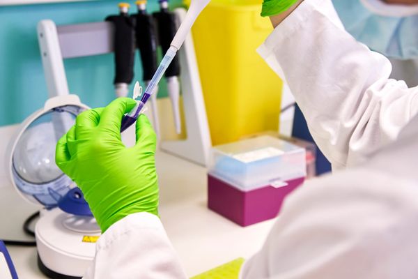 EPO study exposes gaps in patent funding