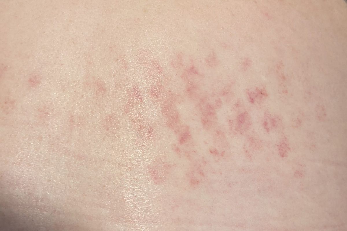 Red Grid Mark Phenomenon: My Experience