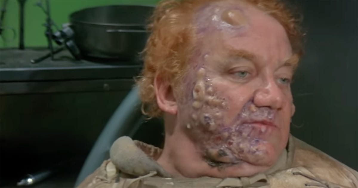 Kenneth McMillan in heavy makeup as a man with orange hair and facial sores, reclining in a dim industrial setting with a distant, calculating expression.