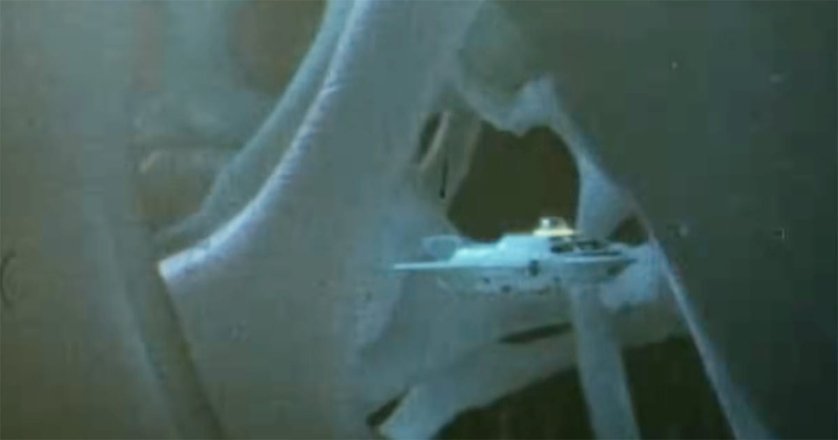 The Proteus navigates tissue deep inside the human body in "Fantastic Voyage".