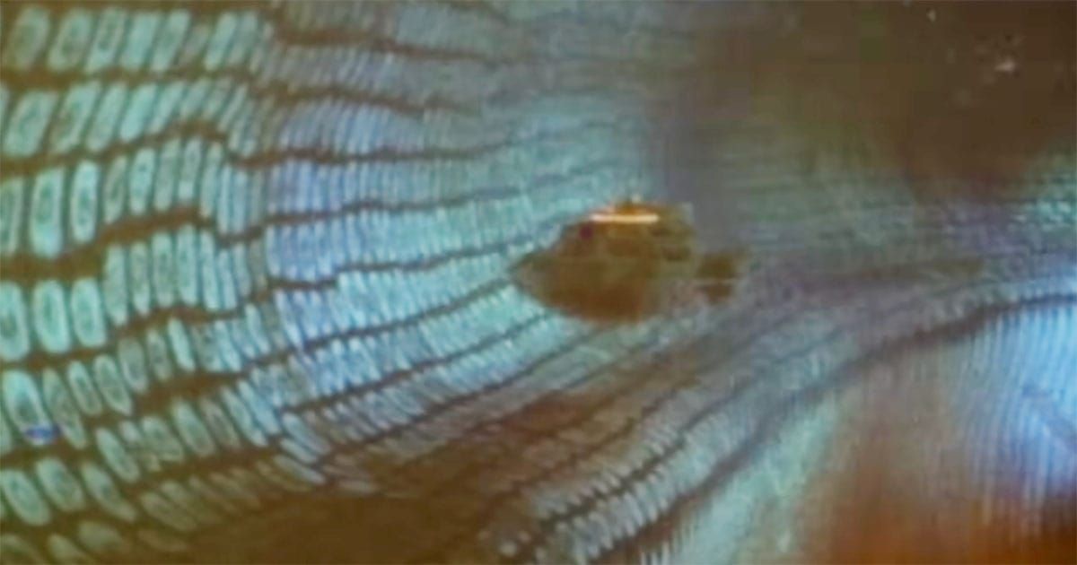 The Proteus submarine travels through a vessel inside the human body in "Fantastic Voyage".