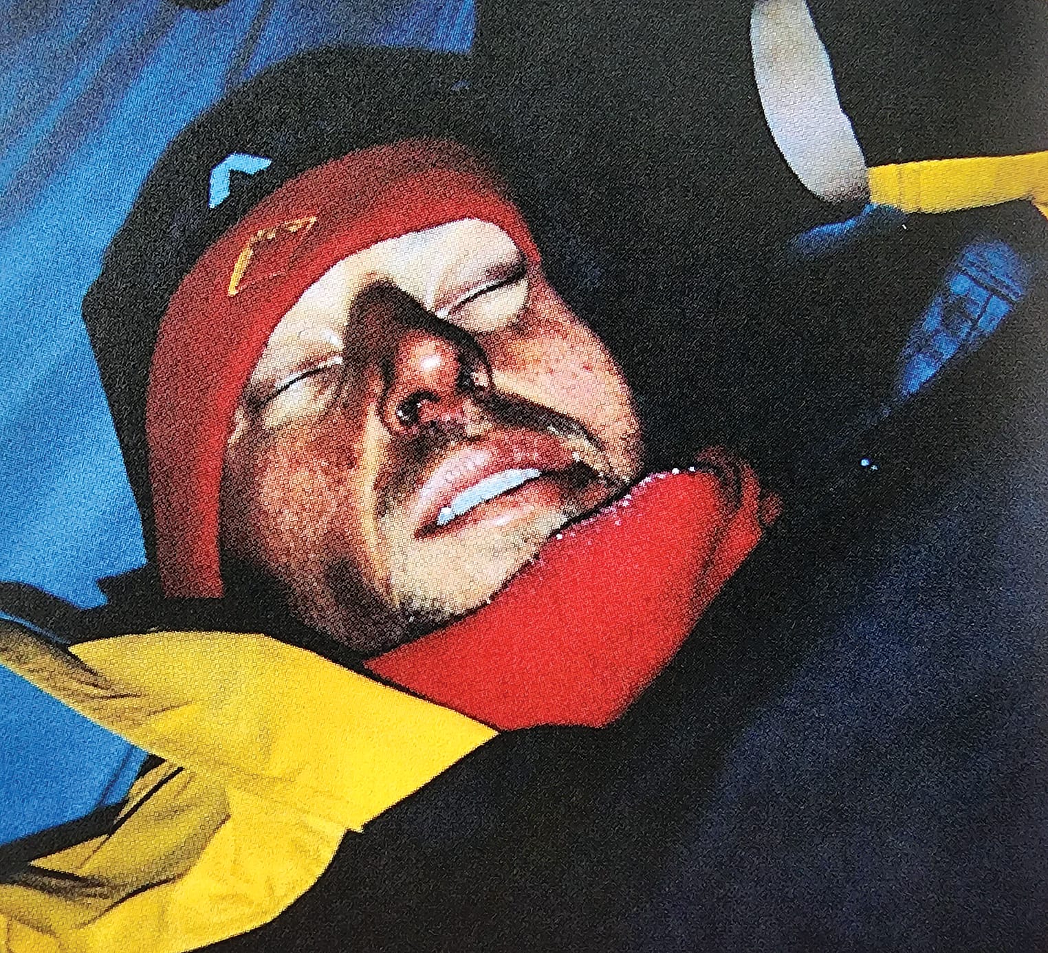 Peter inside the tent awaiting rescue – his injuries included a fractured skull, dislocated hip, fractured bones in his feet and ribs.