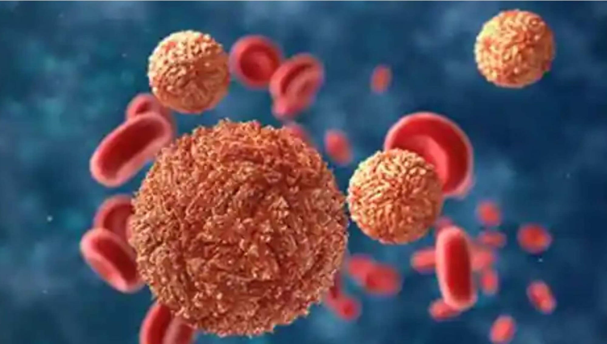 Uh-oh, it's back in significant numbers!