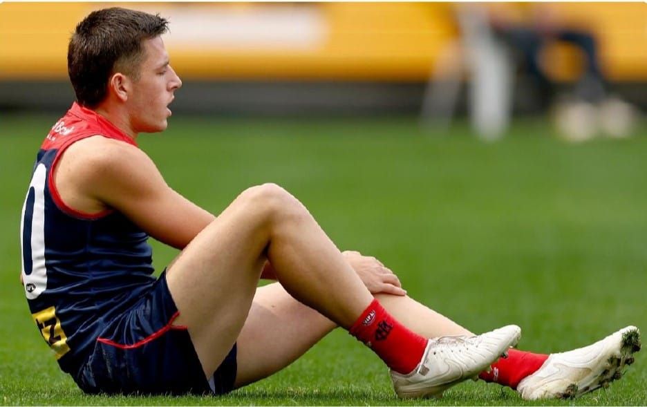 Demons remain ‘hopeful’ despite Xavier Lindsay injury post image