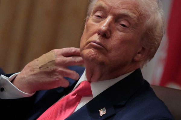 Trump is too vain ever to admit he lost his war against Iran
