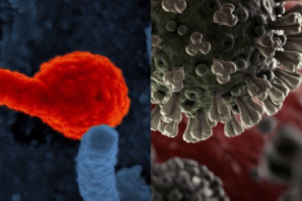 Lecciones del ébola para afrontar el COVID–19