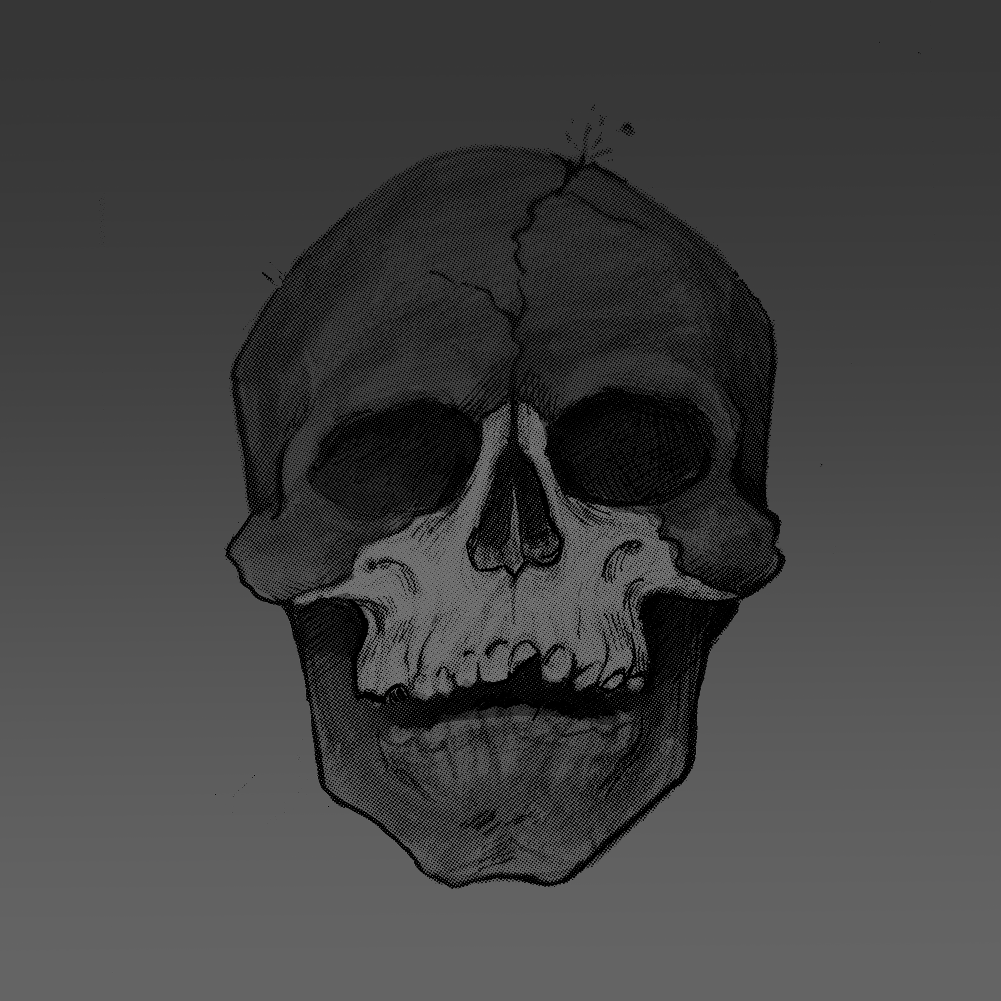 Maxilla