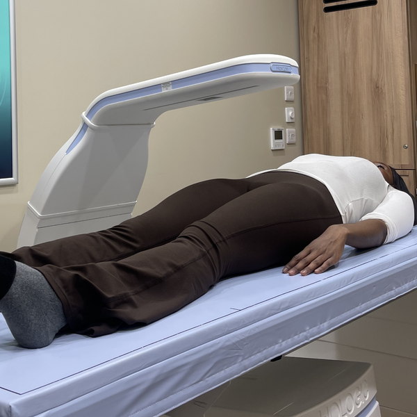 I got a DEXA scan at 31. Here’s what it actually showed.