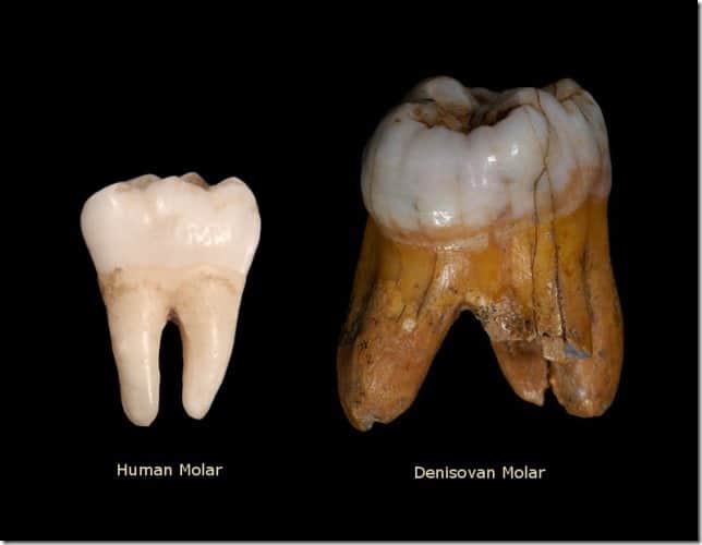 Human Vs Denisovan Molar
