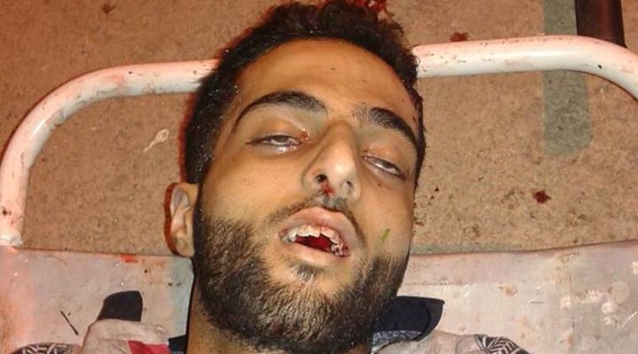 3 Arguments on Kashmir Terror by Liberals and Their Rebuttals!