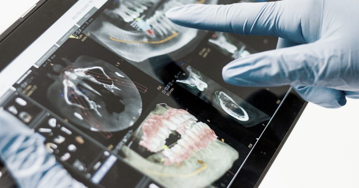 Why Canada’s $13B Dental Plan May Not Deliver Timely Care