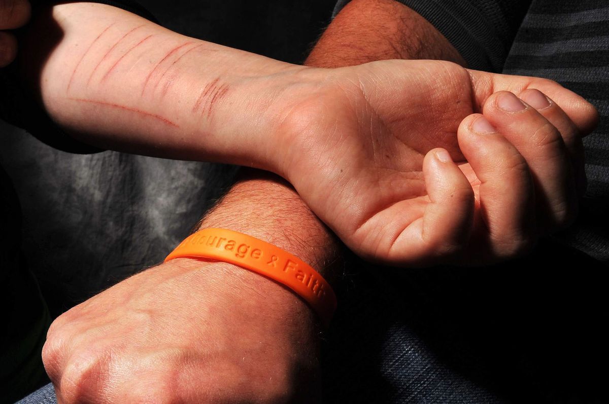 A automutilação segundo a Nova Medicina Germânica