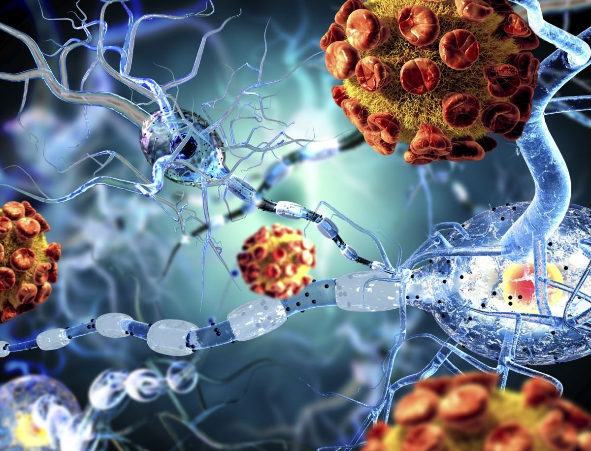 Esclerose Múltipla e Doença de Parkinson