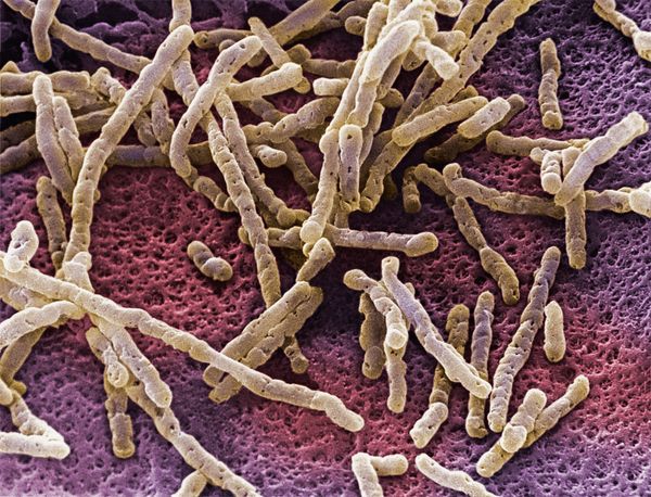 O que é a Candidíase para a Nova Medicina Germânica?