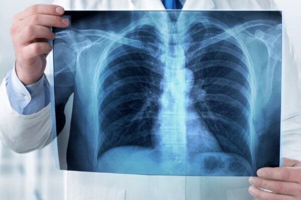 Cardiomegalia de acordo com a Germânica Heilkunde