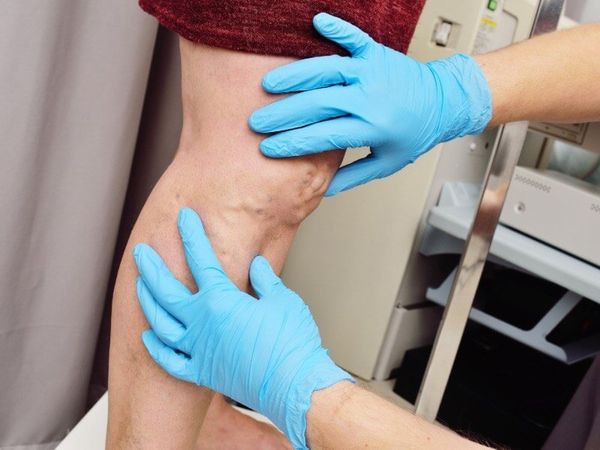 O que é flebite segundo a Germânica Heilkunde?