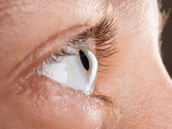 O que é o Ceratocone? Pela Germânica Heilkunde