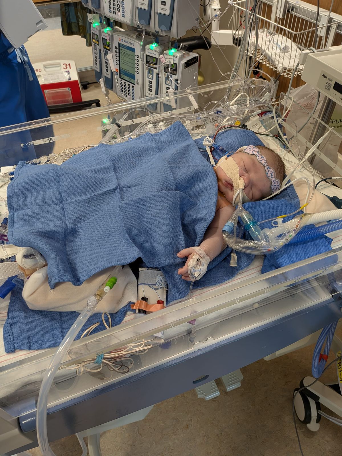 The Norwood Procedure