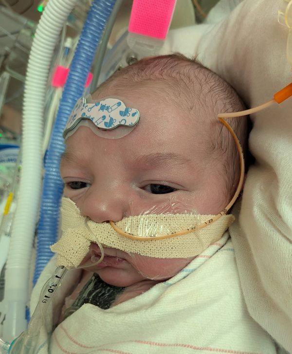 Week #2 Update