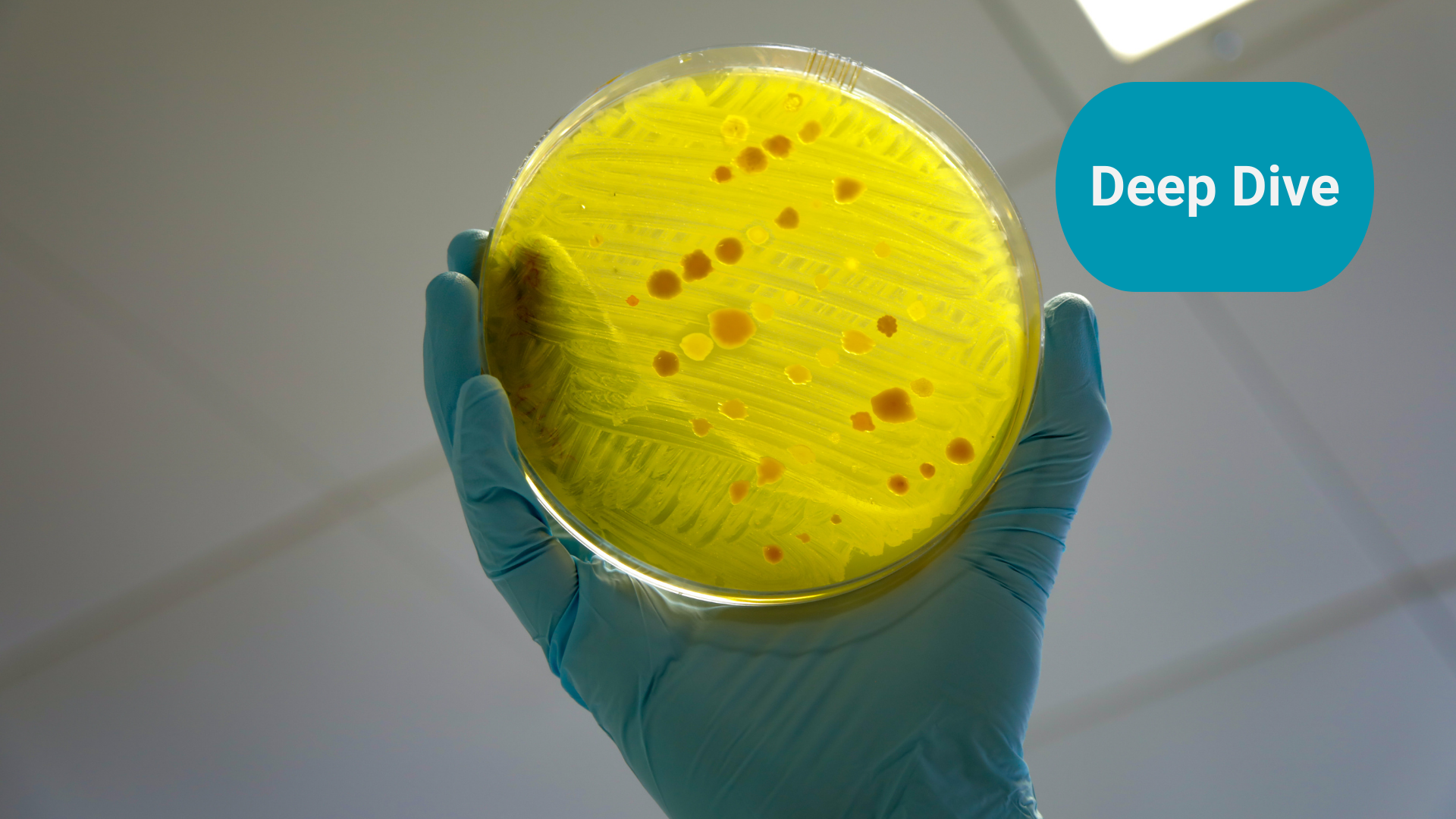 Antimicrobial Resistance: a primer