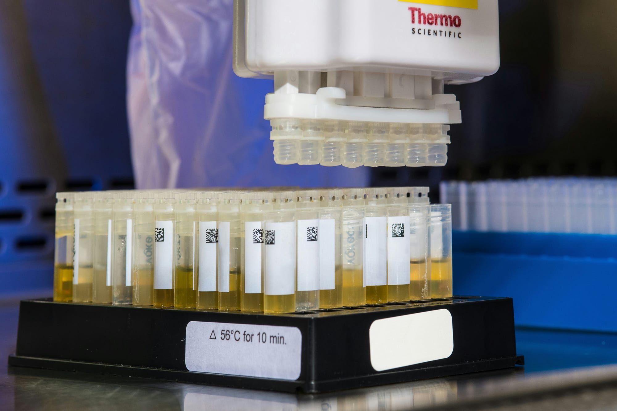 A new wee test for bowel cancer?