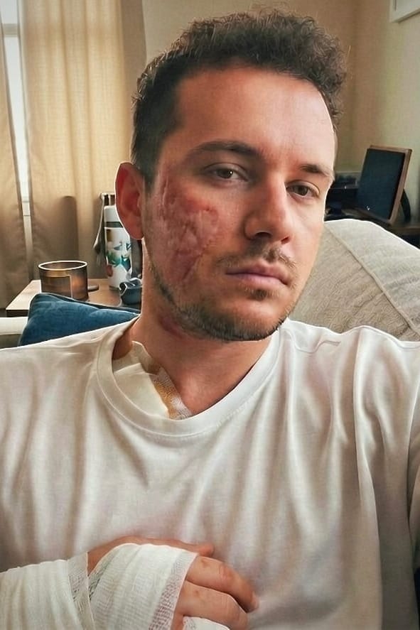 Plan rapproché d’un homme portant un t-shirt blanc, avec des cicatrices visibles sur la joue droite. Il présente un pansement au niveau de la clavicule ainsi qu’un bandage enveloppant sa main et son poignet droits.