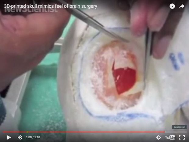 3D Printed Brain for surgical training
