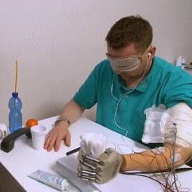 Bionic hand with sensory feedback