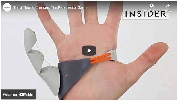 Video of the Day: Prosthetic Third Thumb