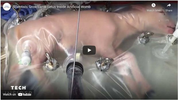 Video of the Day: Artificial Womb