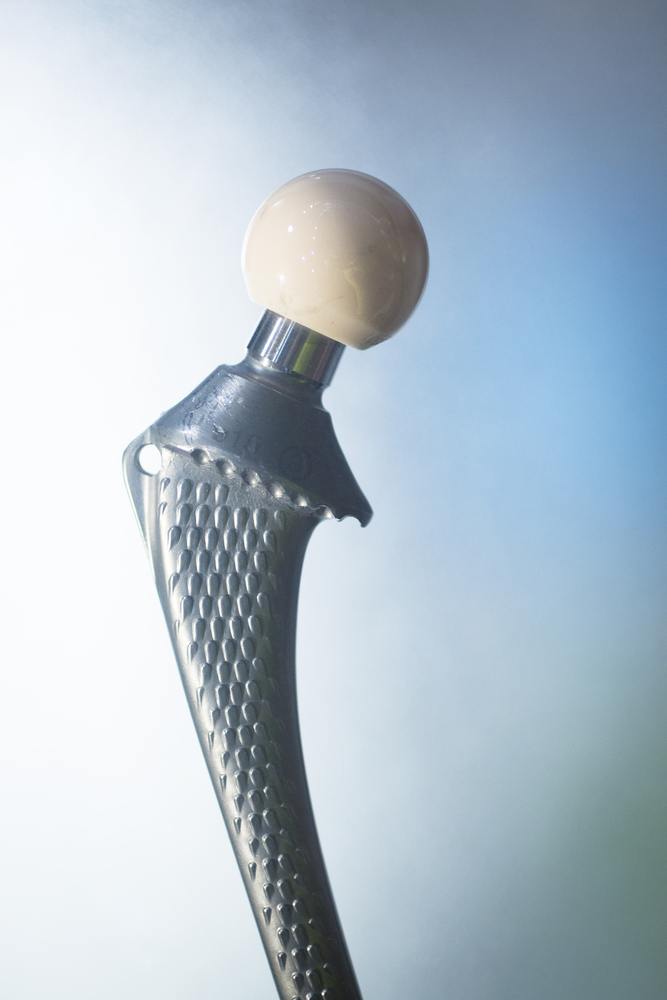 Ti-6Al-4V hip implant