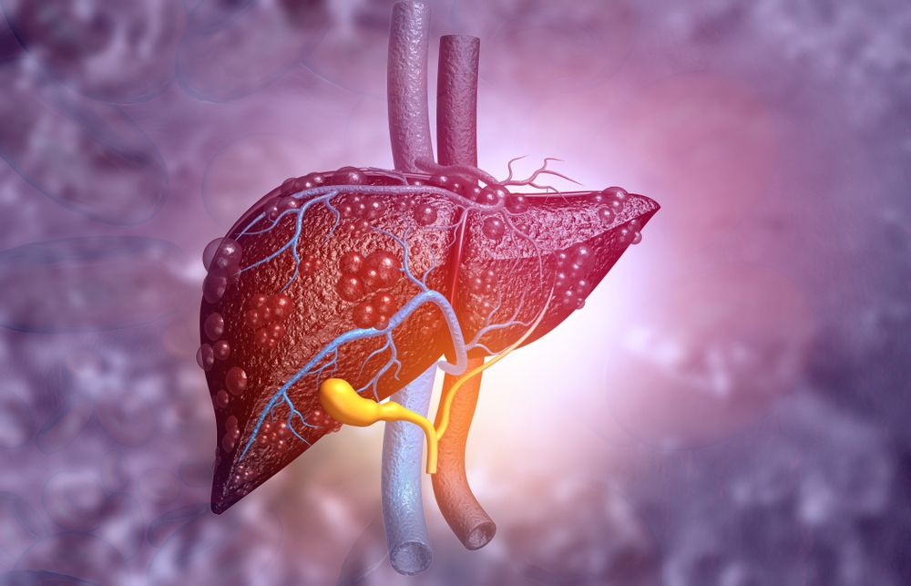 An overview of alcoholic liver disease