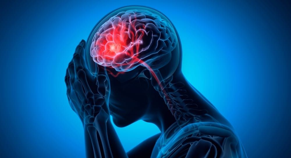 Recognizing stroke: key signs and symptoms