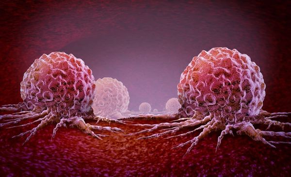 An overview of ovarian and prostate cancer