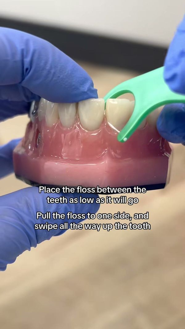 Blue-gloved hands demonstrate flossing on a dental model with a green floss pick at Longworth Dental Courtice.