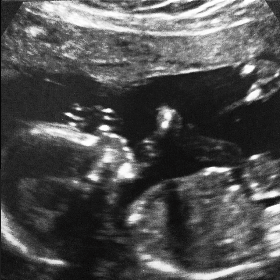My Big News: I’m Pregnant and Moving to Greener Pastures