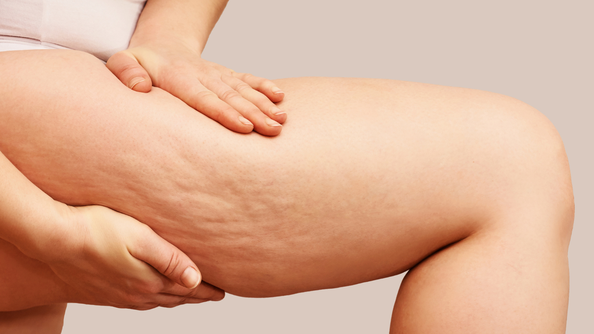 Bone Broth: A Cure for Cellulite?