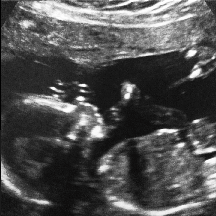 My Big News: I’m Pregnant and Moving to Greener Pastures