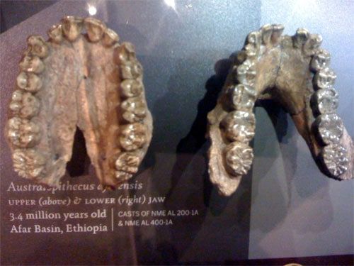 jaw