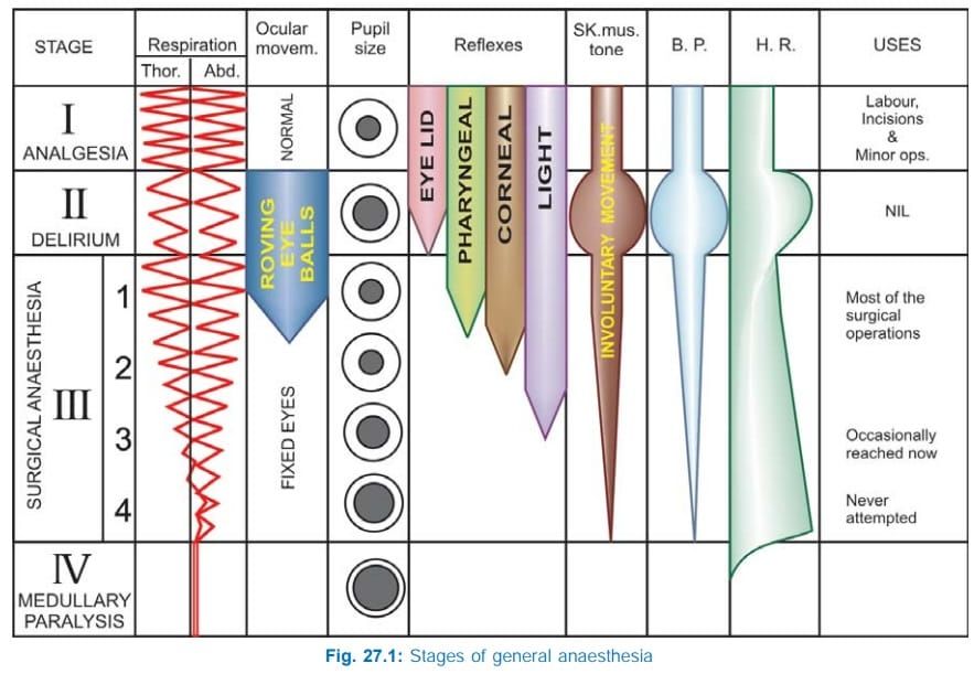 Guedel's stages of anaesthesia