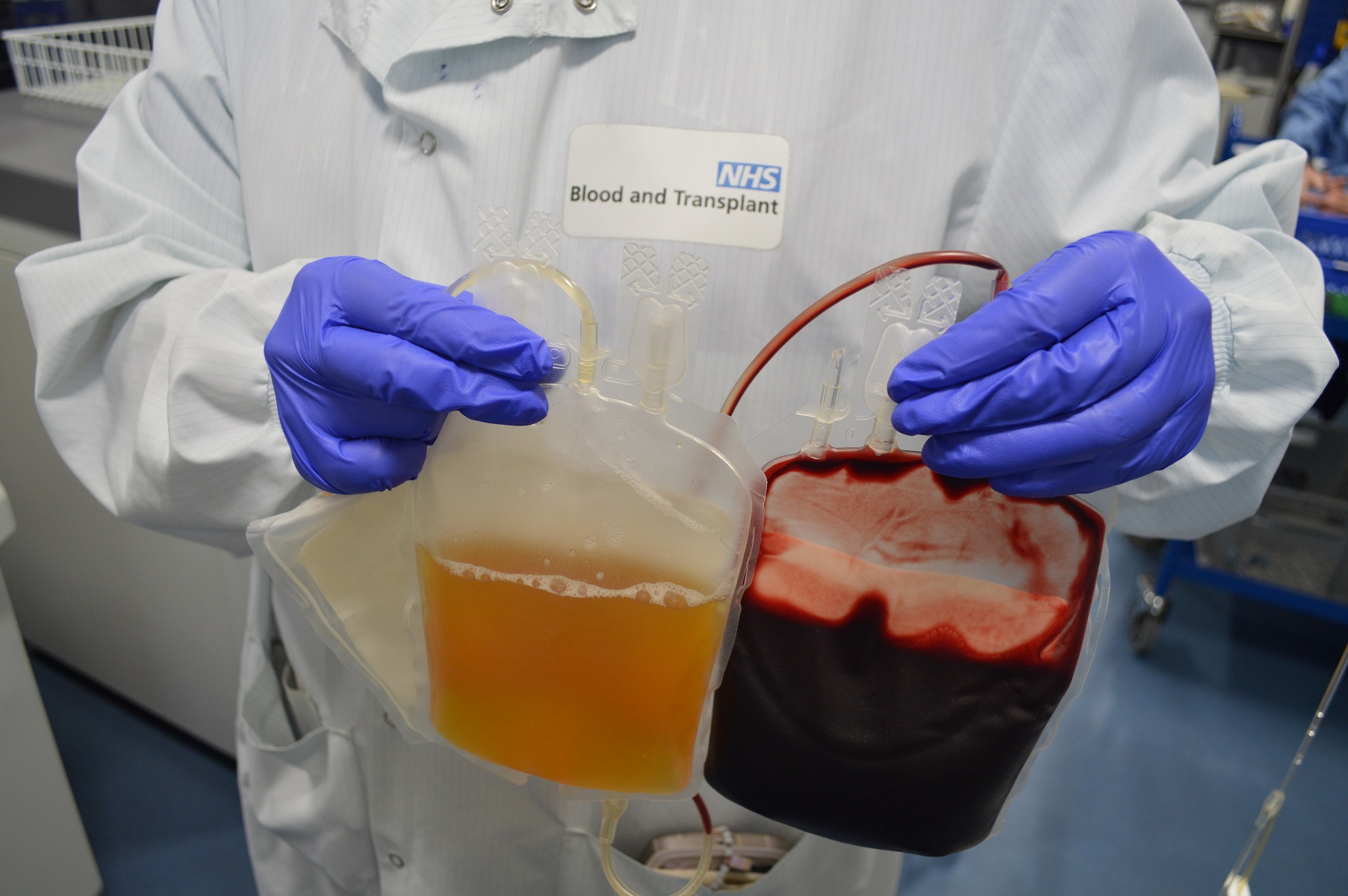 Plasma separated from red blood cells